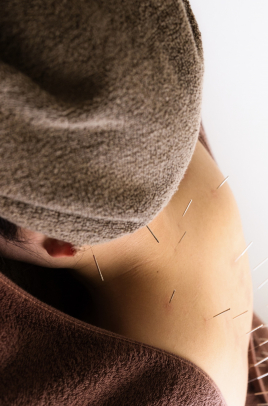 久留米 美容鍼灸院warmly  鍼灸治療［体の一部位］のメニュー画像