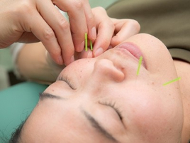 押上駅前整骨院 美容鍼のメニュー画像