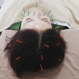 鍼灸治療室 ゆう 鍼灸セット治療(全身調整90分＋美容鍼)のメニュー画像