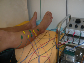 ときだ接骨院鍼灸院 鍼治療のメニュー画像