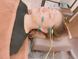 鍼灸サロン-aiwa- 美容鍼のメニュー画像