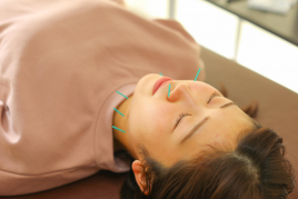 おざわ鍼灸接骨院 美容鍼のメニュー画像