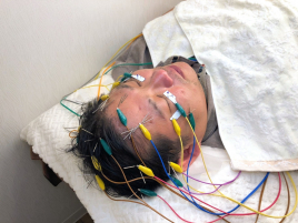 Brilo（ブリーロ）美容鍼灸サロン 電気を流す頭皮鍼のメニュー画像