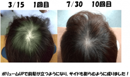 からだの治療院おあしす 脱毛症、薄毛,鍼治療　のメニュー画像