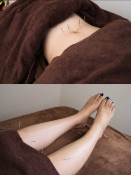 久留米 美容鍼灸院warmly  美腸活鍼［内臓調節］のメニュー画像