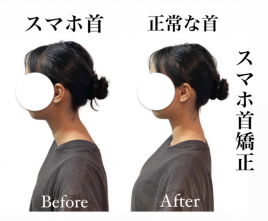 美容鍼灸整体 HARIKA 東京 新宿店 スマホ首 矯正のメニュー画像