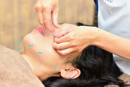 鍼灸TASUKU治療室 美容鍼ベーシックのメニュー画像