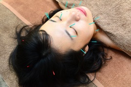 鍼灸TASUKU治療室 美容鍼プラスのメニュー画像