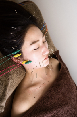 久留米 美容鍼灸院warmly  美容鍼灸［顔･頭･首周り］［60本］のメニュー画像