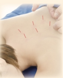 レモンキュア平塚治療院 鍼灸＋マッサージコースのメニュー画像