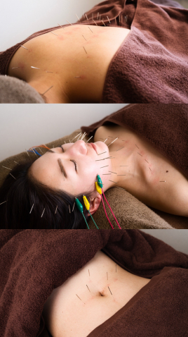 久留米 美容鍼灸院warmly  warmlyフルコースのメニュー画像