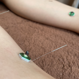 鍼灸salon Cherir -シェリール- 鍼灸施術のメニュー画像