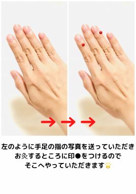 さっぽろ心灯はり・きゅう院 オンラインお灸のメニュー画像