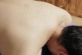 UESUGI美容鍼灸整骨院 (初回)　お身体の鍼治療のメニュー画像