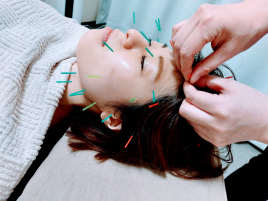 鍼灸治療室 ゆう 美容鍼(顔・頭部)のメニュー画像