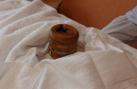 はりとお灸よもぎ 婦人科疾患コースのメニュー画像