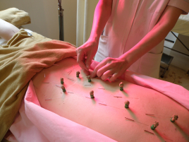 鍼灸仲町台治療院 鍼・灸・気功・ヒーリング(120分)のメニュー画像