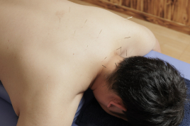 UESUGI美容鍼灸整骨院 お身体の鍼治療　２回目以降の方のメニュー画像