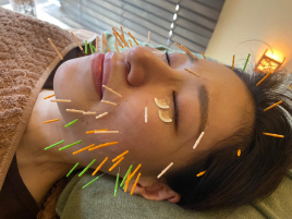 Acupuncture salon LINOA リノア鍼灸院 美容鍼灸 Basicのメニュー画像