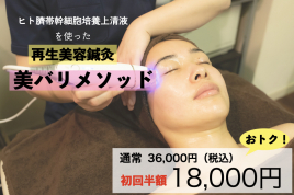 JOY|Relaxing×Conditioning 【初回半額】美バリメソッド美容鍼のメニュー画像