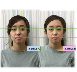 たきがみ鍼灸整骨院 美容鍼のメニュー画像