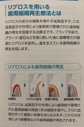 こばし鍼灸(掃骨)院 🌟こばしの技術のメニュー画像