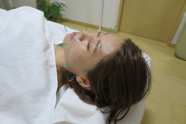 鍼灸有宮〈ありみや〉 ハリ・ツヤ美容鍼のメニュー画像