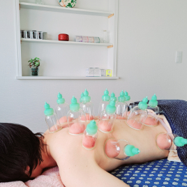 小さな治療院　鍼灸サロン雫　-shizuku-  しずくの吸い玉（背中以外も可）のメニュー画像