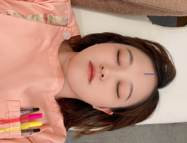 きき鍼灸院 小顔美容鍼灸 2回目以降のメニュー画像