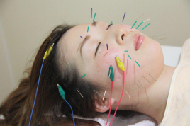 こん野鍼灸・整骨院 プレミアム美容鍼のメニュー画像