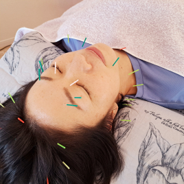 小さな治療院　鍼灸サロン雫　-shizuku-  初回お試し　しずく美容鍼のメニュー画像