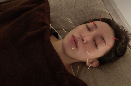 女性専用美容鍼灸サロンLupinus 【顔ケア（美容鍼）60分】コースのメニュー画像