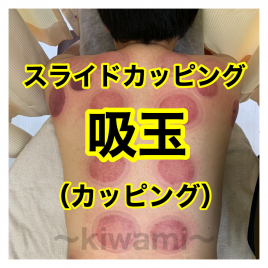 鍼灸・整骨　kiwami（男性専門の鍼灸整骨院） スライドカッピング・吸玉（カッピング）のメニュー画像