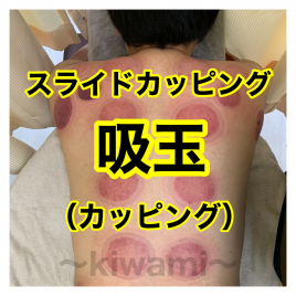 鍼灸・整骨 kiwami(男性専門の鍼灸整骨院) スライドカッピング・吸玉(カッピング)のメニュー画像