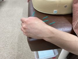 与野名倉堂鍼灸整骨院 局所の鍼灸施術　（トリガーポイント療法）のメニュー画像