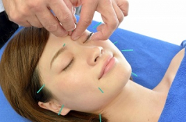 大塚鍼灸院 治療メニュー 2.　美容鍼のメニュー画像