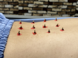 IKKYU〜はり・きゅう・マッサージ〜 鍼灸マッサージコースマッサージ多めのメニュー画像