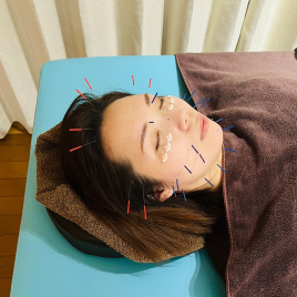 ロハリ鍼灸整骨院 美容鍼 トライアルコース (初回限定)のメニュー画像