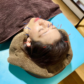 ロハリ鍼灸整骨院 美容鍼　ベーシックコース(顔面施術)のメニュー画像