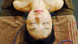 山中鍼灸院 リフトアップ美容鍼ショートコースのメニュー画像