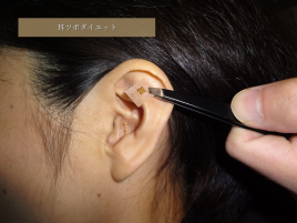 長谷川亮・鍼灸院 サプリメントを使わない耳ツボダイエットのメニュー画像