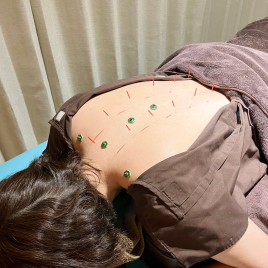 ロハリ鍼灸整骨院 自律神経調整コースのメニュー画像