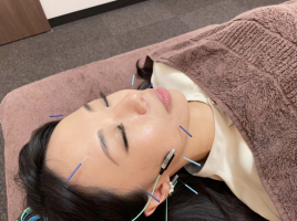 女性専用はりきゅうサロン haruyui 電気を流す美容鍼（少ない本数で最大効果）のメニュー画像