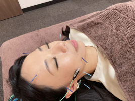 女性専用はりきゅうサロン haruyui 電気を流す美容鍼(少ない本数で最大効果)のメニュー画像