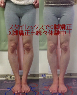 フィジカルメンテ癒楽 O脚　X脚矯正のメニュー画像