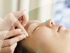 福山鍼灸接骨院 美容鍼のメニュー画像