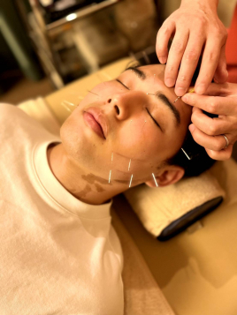 マッサージ　はり・灸　ユーカリ 顔鍼マッサージのメニュー画像