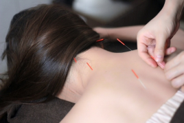 美容鍼灸サロンYOSHINO 鍼灸治療のメニュー画像