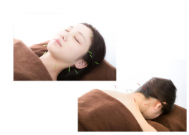 鍼灸　楓 全身調整＋美容鍼のメニュー画像
