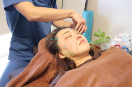  FUTS鍼灸整体院 美容鍼（お顔のみコース）のメニュー画像